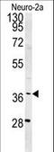 U5 small nuclear ribonucleoprotein 40 kDa protein antibody, LS-C161349, Lifespan Biosciences, Western Blot image 