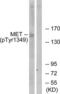c-met antibody, LS-C117417, Lifespan Biosciences, Western Blot image 