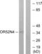 Olfactory Receptor Family 52 Subfamily N Member 4 (Gene/Pseudogene) antibody, abx015380, Abbexa, Western Blot image 