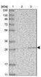 Abhydrolase Domain Containing 10 antibody, PA5-57905, Invitrogen Antibodies, Western Blot image 