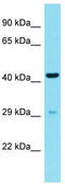 CMT1A Duplicated Region Transcript 15 Like 2 antibody, TA334829, Origene, Western Blot image 