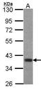 Forkhead box protein B1 antibody, GTX104844, GeneTex, Western Blot image 