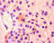Fatty Acid Binding Protein 3 antibody, A52893-100, Epigentek, Immunohistochemistry paraffin image 