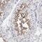 Fibrous sheath CABYR-binding protein antibody, PA5-51957, Invitrogen Antibodies, Immunohistochemistry paraffin image 