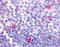 Cannabinoid Receptor 2 antibody, TA317639, Origene, Immunohistochemistry frozen image 