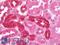 Ras antibody, LS-B10113, Lifespan Biosciences, Immunohistochemistry paraffin image 