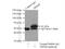 Tripartite Motif Containing 9 antibody, 10786-1-AP, Proteintech Group, Immunoprecipitation image 