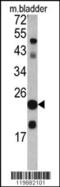 Transgelin antibody, 62-395, ProSci, Western Blot image 