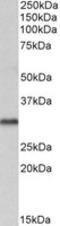 Voltage-dependent anion-selective channel protein 2 antibody, MBS420094, MyBioSource, Western Blot image 