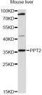 Palmitoyl-Protein Thioesterase 2 antibody, abx126409, Abbexa, Western Blot image 