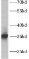 Aspartoacylase-2 antibody, FNab00132, FineTest, Western Blot image 