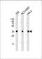 Ubiquitin C-Terminal Hydrolase L5 antibody, M04276, Boster Biological Technology, Western Blot image 
