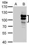 L3MBTL Histone Methyl-Lysine Binding Protein 1 antibody, TA308637, Origene, Western Blot image 