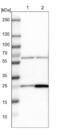 Mitochondrial Ribosomal Protein S7 antibody, NBP1-81029, Novus Biologicals, Western Blot image 
