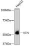 Vitronectin antibody, 13-961, ProSci, Western Blot image 