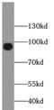 Forkhead Box O3 antibody, FNab03202, FineTest, Western Blot image 