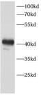 Calcium Binding Protein 39 Like antibody, FNab10425, FineTest, Western Blot image 