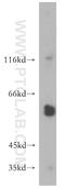 Matrix Metallopeptidase 23B antibody, 13020-1-AP, Proteintech Group, Western Blot image 