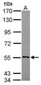 Cytochrome B5 Reductase 4 antibody, PA5-31370, Invitrogen Antibodies, Western Blot image 