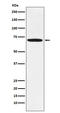 LIM Domain Kinase 1 antibody, M01323-1, Boster Biological Technology, Western Blot image 