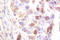 RPA32 antibody, LS-C176556, Lifespan Biosciences, Immunohistochemistry paraffin image 