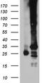 Translocase Of Inner Mitochondrial Membrane 29 antibody, CF811979, Origene, Western Blot image 