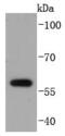 E2F-1 antibody, A00257-1, Boster Biological Technology, Western Blot image 