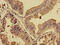 SEC12 antibody, LS-C672896, Lifespan Biosciences, Immunohistochemistry paraffin image 