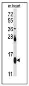 Fatty Acid Binding Protein 4 antibody, AP12406PU-N, Origene, Western Blot image 