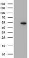 Peroxisome Proliferator Activated Receptor Alpha antibody, TA503529, Origene, Western Blot image 