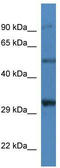 Sarcoglycan Delta antibody, TA335222, Origene, Western Blot image 