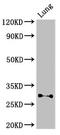 Serine Peptidase Inhibitor, Kunitz Type 2 antibody, orb400548, Biorbyt, Western Blot image 