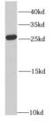 Ras-related protein Rab-27A antibody, FNab07009, FineTest, Western Blot image 