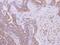 Kelch Repeat And BTB Domain Containing 3 antibody, PA5-32116, Invitrogen Antibodies, Immunohistochemistry frozen image 