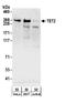 Methylcytosine dioxygenase TET2 antibody, A304-247A, Bethyl Labs, Western Blot image 