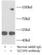 Sodium-iodide symporter antibody, FNab08107, FineTest, Immunoprecipitation image 