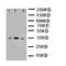 Succinate Dehydrogenase Complex Iron Sulfur Subunit B antibody, orb76232, Biorbyt, Western Blot image 