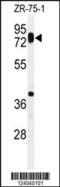 Hyaluronan Synthase 1 antibody, 61-718, ProSci, Western Blot image 
