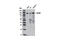 EPH Receptor A2 antibody, 12927S, Cell Signaling Technology, Western Blot image 
