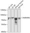 Heterogeneous nuclear ribonucleoprotein M antibody, A6937, ABclonal Technology, Western Blot image 
