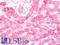 Metallothionein 2A antibody, LS-C316664, Lifespan Biosciences, Immunohistochemistry paraffin image 