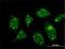 RAB GTPase Activating Protein 1 antibody, H00023637-M01, Novus Biologicals, Immunofluorescence image 