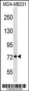 RecQ Mediated Genome Instability 1 antibody, 58-775, ProSci, Western Blot image 