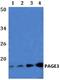 PAGE Family Member 3 antibody, A18245, Boster Biological Technology, Western Blot image 