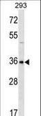 Homeobox protein GBX-1 antibody, LS-C166400, Lifespan Biosciences, Western Blot image 