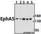 Ephrin type-A receptor 5 antibody, A01494Y515, Boster Biological Technology, Western Blot image 