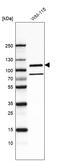 Integrin beta-8 antibody, AMAb91467, Atlas Antibodies, Western Blot image 