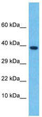 Left-Right Determination Factor 2 antibody, TA346347, Origene, Western Blot image 