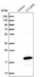 Chromosome 11 Open Reading Frame 45 antibody, PA5-58897, Invitrogen Antibodies, Western Blot image 
