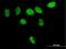 Poly(ADP-ribose) glycohydrolase antibody, H00008505-B01P, Novus Biologicals, Immunocytochemistry image 